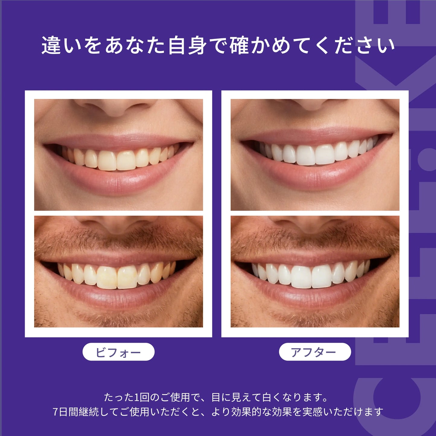 Ceelike nHAP Pro ホワイトニングシート｜過酸化物不使用
