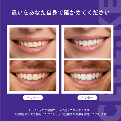 Ceelike nHAP Pro ホワイトニングシート｜過酸化物不使用